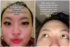 Bulu mata cewek ini jadi botak usai eyelash extension, kisahnya bikin nyesek pol