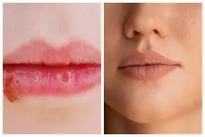 Cara atasi bibir kering cuma andalkan petroleum jelly dan gula, hasilnya tampak lembap dan glossy