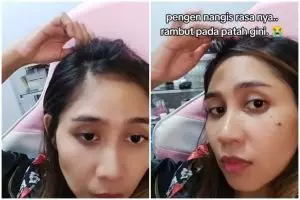 Rambut cewek ini jadi mirip bulu landak usai hair smoothing, akibat pakai produk tak sesuai aturan