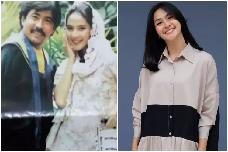 Potret Maudy Koesnaedi di awal karier & sesudah kenal treatment antiaging Berbagai sumber