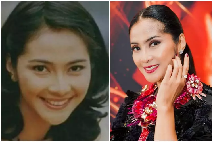 Potret Maudy Koesnaedi di awal karier & sesudah kenal treatment antiaging Berbagai sumber
