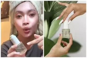 Sempat viral di TikTok, review Thingskin Brightening Serum yang diklaim bisa pudarkan bekas jerawat