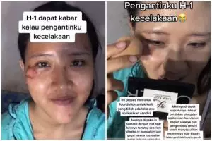 Kecelakaan H-1 menikah bikin wajah babak belur, hasil riasan pengantin cewek ini flawless tanpa luka