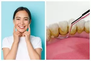 Trik hilangkan gigi kuning berkerak satu menit ini cuma butuh 2 bahan dapur, begini cara pakainya