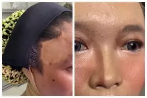 Kulit belang karena bekas operasi, MUA ini sulap wajah pengantin Jawa jadi mulus dan anticrack