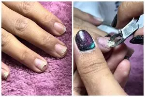 Jelang pernikahan kuku wanita ini rusak dan berjamur akibat bail extension, begini cara mengatasinya