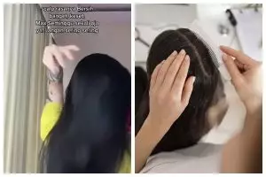 Cara atasi ketombe ini cuma pakai kombinasi sampo dan 1 bahan dapur, rambut auto bersih & lembut