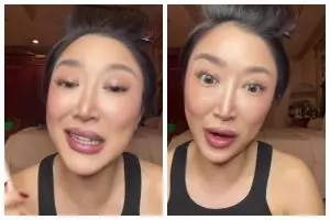 Dikira bisa atasi bibir kering, kisah wanita coba produk lip balm baru ini berujung alergi