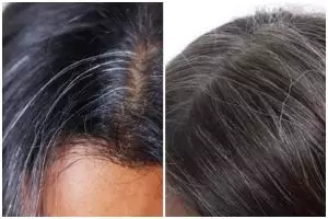 [KUIS] Uban bisa disamarkan tanpa bahan kimia, pilih 1 bahan alami di dapurmu untuk tahu caranya