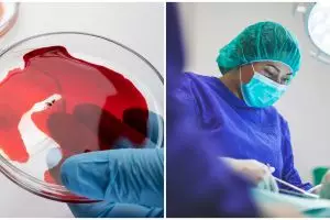 Benarkah stem cell tali pusat dapat menyembuhkan penyakit? Ini prosedur dan manfaatnya