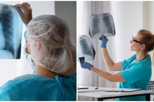 Ampuh deteksi kanker paru, kenali Endobronchial Ultrasound, prosedur dan pemulihannya