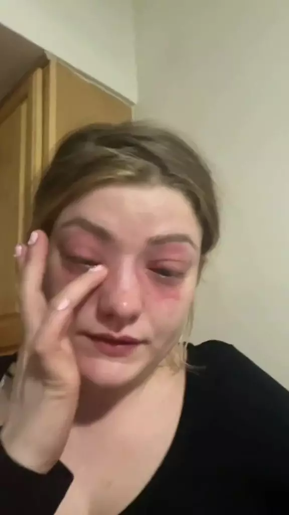 Intentions to be beautiful ended in irritation, this woman was