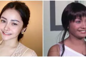 Bangga pernah lakukan operasi plastik, segini dana yang dibayarkan Mawar AFI untuk percantik hidung