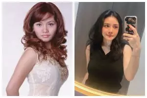 Habiskan Rp 200 juta untuk operasi wajah, ini 11 transformasi Mawar AFI dari awal karier hingga kini