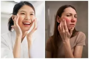 Pakai sunscreen buat lindungi kulit dari sinar matahari, wanita ini alami alergi hingga wajah memerah