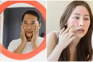 Segera bercermin, 5 tanda bahaya di wajah ini ungkap kesehatan jantungmu
