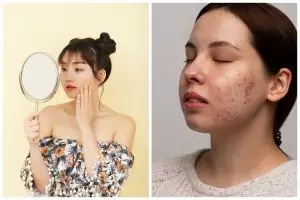 7 Rekomendasi skincare Skintific untuk kulit berjerawat harga mulai Rp100 ribuan