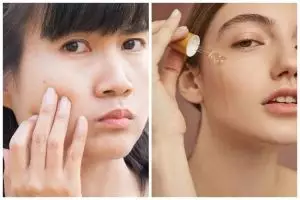 11 Rekomendasi skincare untuk kulit sensitif merek lokal harga di bawah Rp 150 ribu