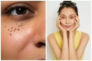 9 Rekomendasi skincare menghilangkan flek hitam harga di bawah Rp 150 ribu, bikin kulit awet muda