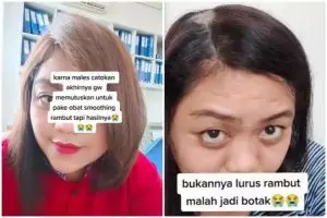 Lakukan smoothing mandiri agar rambut lebih halus, wanita ini justru alami botak koin usai treatment