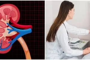 Viral banyak anak cuci darah di RSCM, ini 10 penyebab gagal ginjal pada usia dini