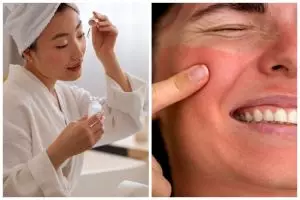 Bahaya skincare merkuri bagi kesehatan tubuh, bisa sebabkan penyakit ginjal serius