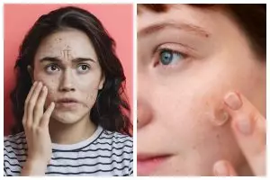 7 Produk skincare Glad2Glow untuk kulit sensitif, bikin kulit iritasi jadi auto tenang