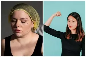 Heboh selebgram meninggal dunia usai sedot lemak, kenali jenis, prosedur, dan efek samping liposuction