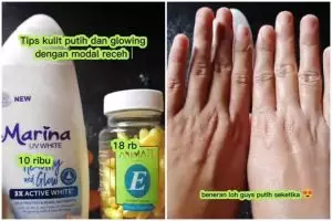 Kombinasi body lotion dan kapsul viral bikin kulit kusam auto putih