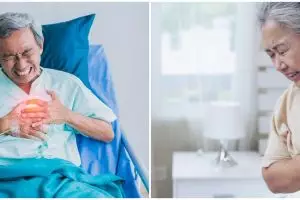 Apa perbedaan antara diseksi aorta tipe A dan tipe B? ini penjelasannya