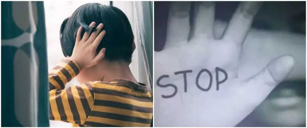 Balita 2 tahun di Depok diduga dianiaya © x