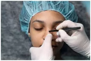 [KUIS] Tren operasi hidung di kalangan seleb, nilai berapa level urgensi kamu buat operasi hidung