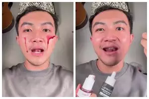 Harganya beda 2x lipat tapi beri efek cerah, battle review peeling serum Elformula dan The Originote