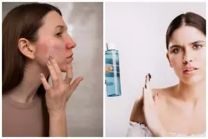 9 Micellar water skincare untuk fungal acne harga di bawah Rp 150 ribu, jerawat auto minggat