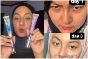 Battle review eye cream Skintific & Glad2Glow harga Rp 200 ribu VS Rp 70 ribu, kualitasnya sama nggak?