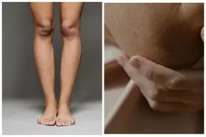 [KUIS] Kebiasaan buruk ini ternyata bisa bikin siku dan lutut gelap, cari tahu lewat pertanyaan ini