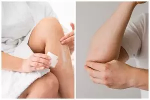 [KUIS] Punya siku atau lutut yang hitam? Yuk cari tahu bahan alami apa untuk bantu cerahkan