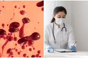 Putus rantai thalasemia dengan mendeteksi sejak dini, kenali ciri dan cara mengatasinya