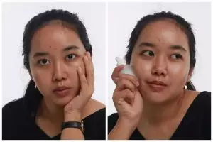 Bantu hilangkan bekas luka, kenali apa itu skincare microneedling, manfaat, dan cara menggunakannya