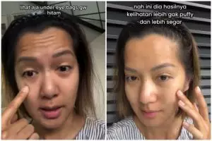 Tanpa beli eye mask mahal, cewek ini bagikan trik atasi puffy eyes cuma pakai seduhan bubuk minuman