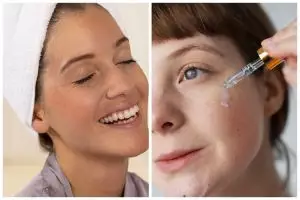 8 Trik menggunakan skincare chemical peeling agar kulit terhindar dari iritasi