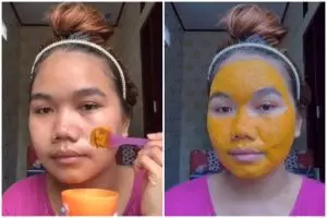 Momen kocak cewek usai pakai masker penghilang bekas jerawat ini bikin kasihan tapi pengen ketawa