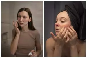 8 Kandungan dan produk skincare untuk memperbaiki skin barrier yang rusak, kulit auto sehat kembali