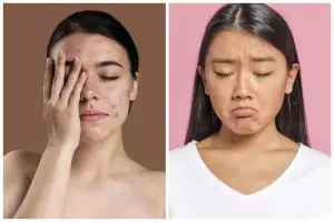 9 Daily skincare routine untuk kulit bruntusan dan kusam serta rekomendasi produknya, jadi auto cerah