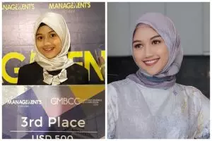 [KUIS] Temukan gaya yang cocok untukmu dari perubahan Erina Gudono sebelum & sesudah pakai behel