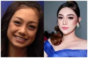 [KUIS] Perawatan ubah penampilan, cari tahu glow up versi artis cantik ini lewat potret masa mudanya