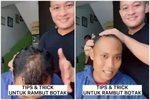 Nggak perlu tanam rambut, trik styling rambut cowok botak depan dan tengah ini cuma perlu 4 langkah