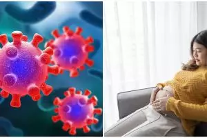 Waspada penularan virus Mpox pada ibu hamil, kenali gejala, dampak pada janin, dan cara mencegahnya