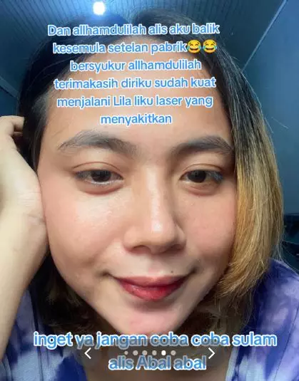 Cewek bagikan kisah sulam alis gagal dan perjuangan laser alis TikTok