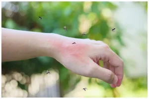 Cara obati kulit alergi usai terkena gigitan serangga, cukup pakai 2 bahan dapur ini